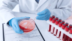 Проблеми визначення груп крові та Резус в лабораторній практиці