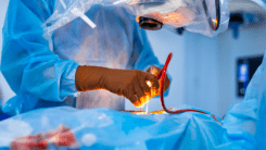 Хірургічний кейс: спліт-трансплантація печінки
