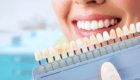 Керамічні вініри в практиці лікаря-стоматолога