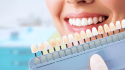QA сесія – Керамічні вініри в практиці лікаря-стоматолога